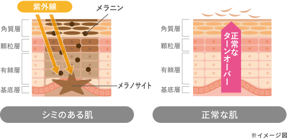 シミのある肌と正常な肌